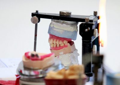Gebiss Szene 2 Zahntechnik Praxis Zahnarzt Dr. Bals